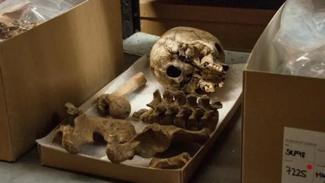 Partes de un esqueleto sobre la tapa de una caja