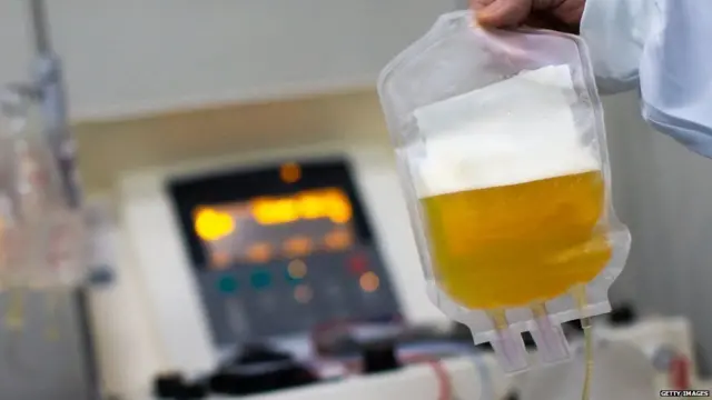 ਪਲਾਜ਼ਮਾ