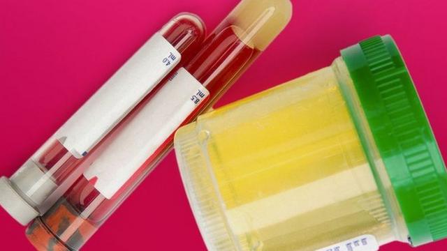 Tubosjeux 1xbetteste e recipientejeux 1xbetplástico