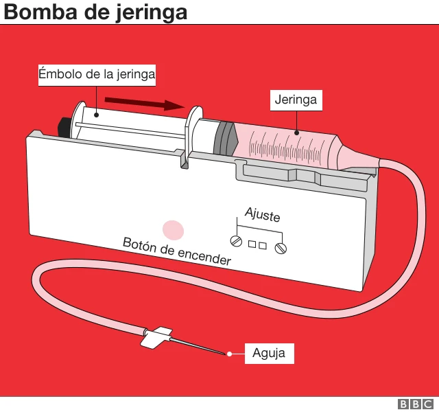 Bomba de jeringa