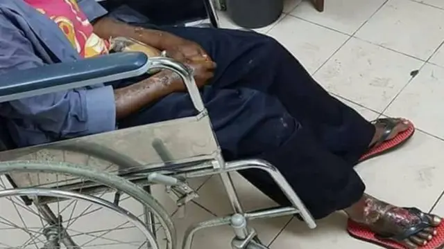 Il est entendu qu'Adelina avait des plaies qui n'avaient pas été traitées et qui avaient été infectées, entraînant une défaillance de son corps.