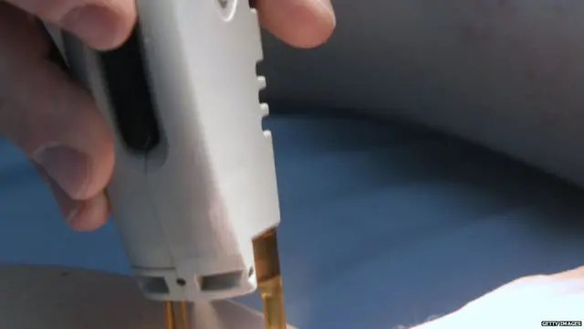 लेज़र ट्रीटमेंट