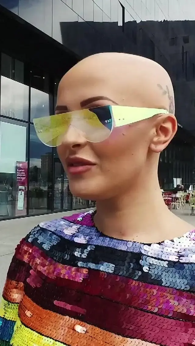 బట్టతల మోడల్