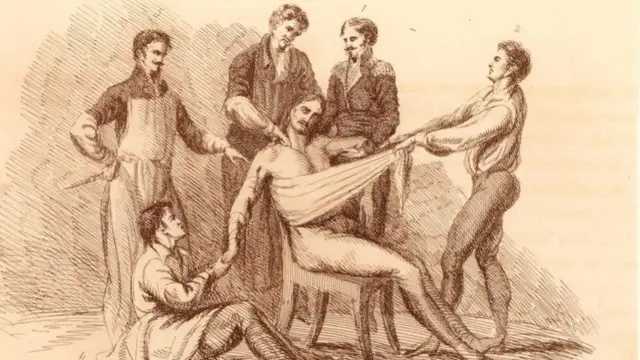 في فترة ما قبل ابتكار عقاقير التخدير، كان يتعين تقييد حركة المرضى خلال خضوعهم للجراحة، ، نظرا لأنهم كان يشعرون جراء ذلك بآلام مبرحة