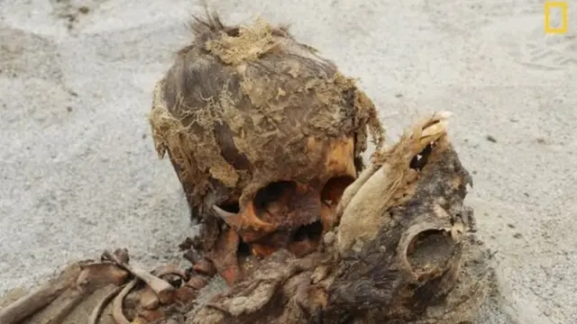 કંકાલની તસવીર