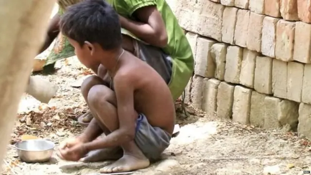 कुपोषण