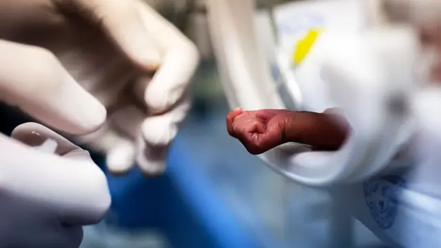 Un enfant soigné dans la couveuse