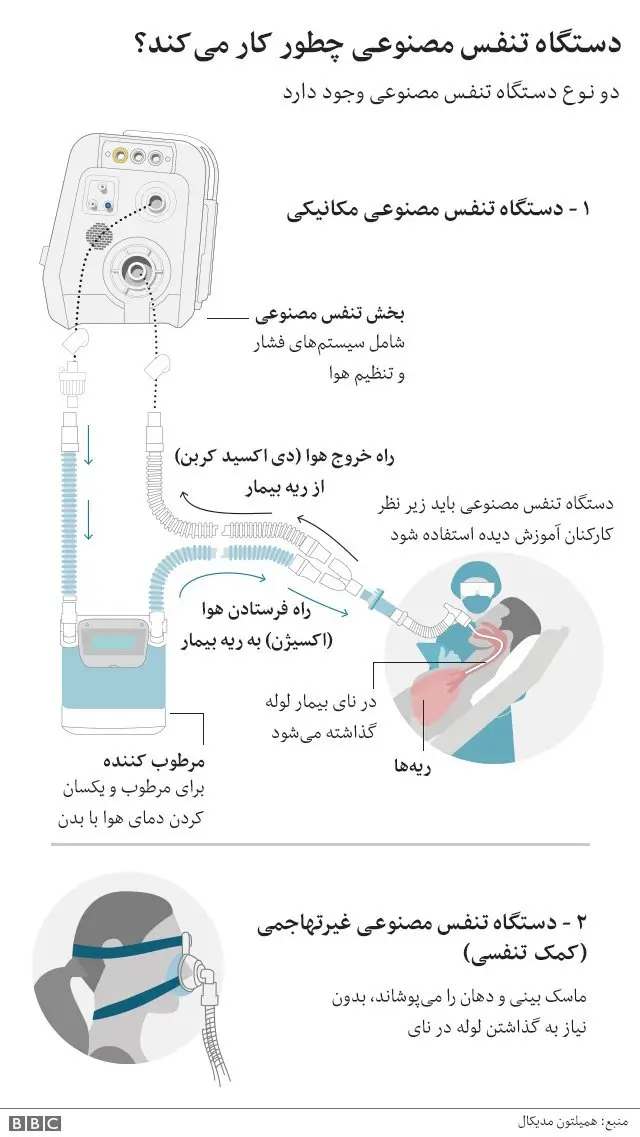 دستگاههای تنفس مصنوعی