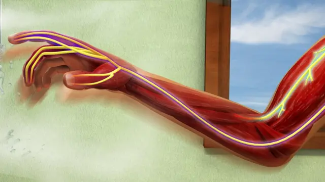 Nervios del brazo y mano