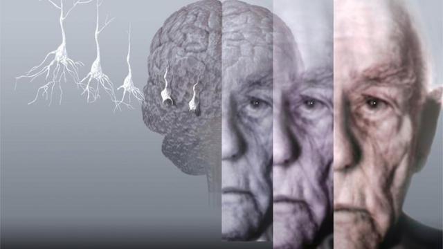 Помощь страдающим от болезни Альцгеймера и деменции | в России | Alzheimer's Association