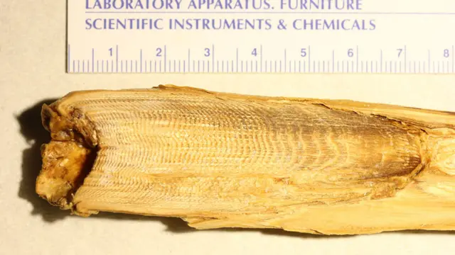 Tapones de cera de los oídos de ballenas