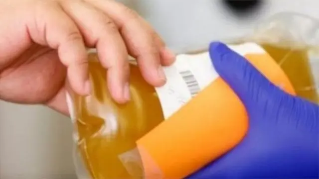 प्लाझ्मा थेरपी