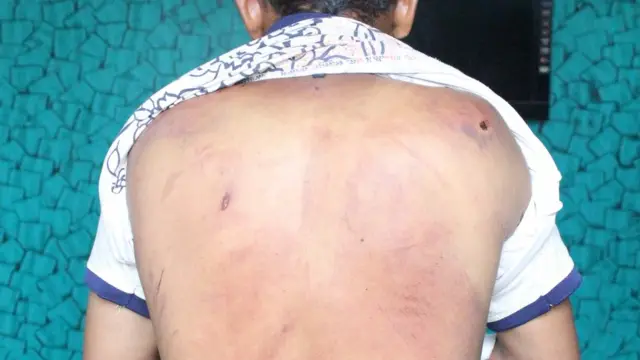 బీదర్ బాధితులు