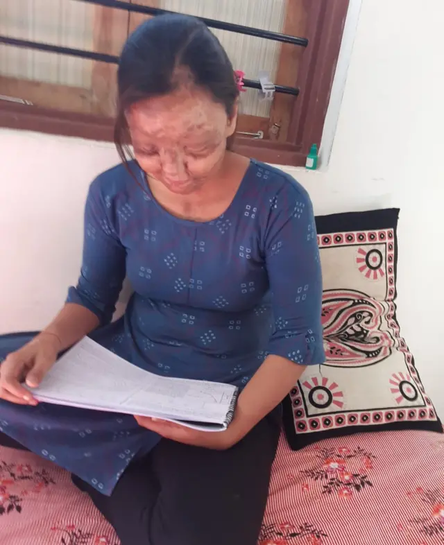 એસિડ હુમલાનો સામનો કર્યા પછી ફરી એક વખત ભણવાનું શરૂ કરી સનદી અધિકારી બનવા માગે છે કાજલ