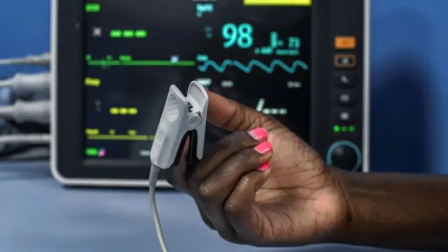 অক্সিমিটার