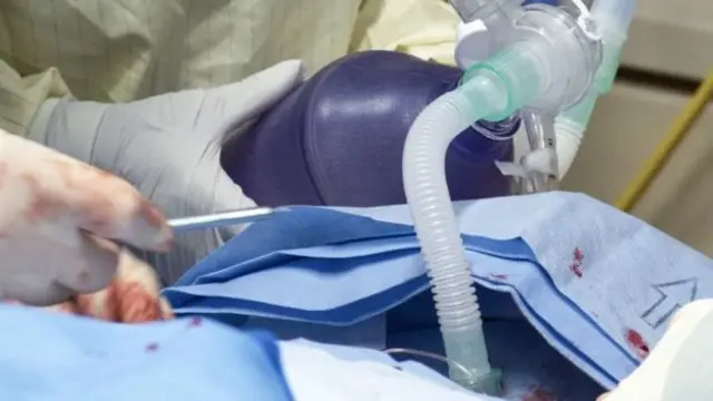 ऑपरेशन (फ़ाइल फोटो)