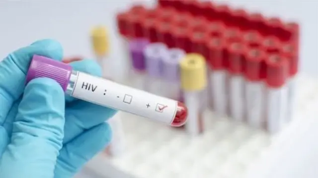Uchunguzi wa damu ni muhimu ili kubaini kama una virusi vya HIV