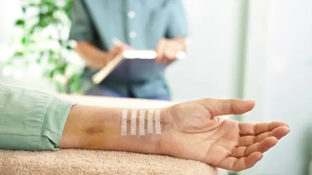 Herida cosida en el brazo.