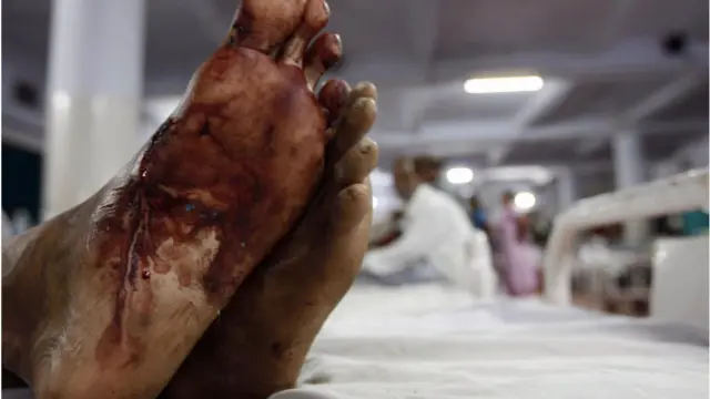 અમદાવાદ બ્લાસ્ટમાં ઘણા લોકો ઈજાગ્રસ્ત થયા હતા