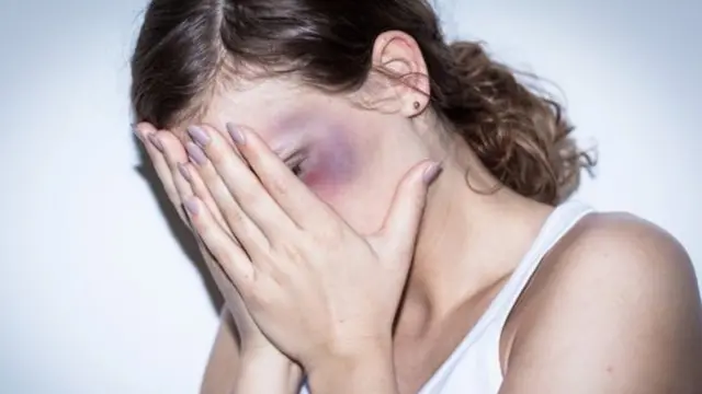 Жена покрива лице рукама