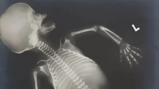 બાળકે આ બીમારી સાથે જન્મી પણ શકે છે અથવા જન્મ પછી પણ આ રોગ વિકસી શકે છે