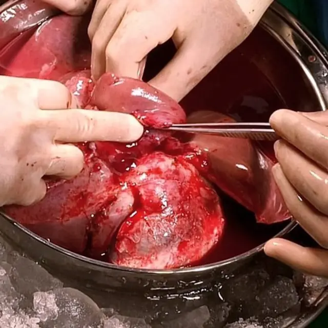 ڈاکٹرز آپریشن کرتے ہوئے