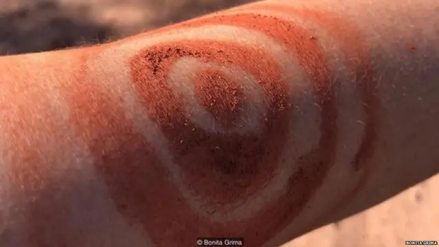 अवसाद का इलाज