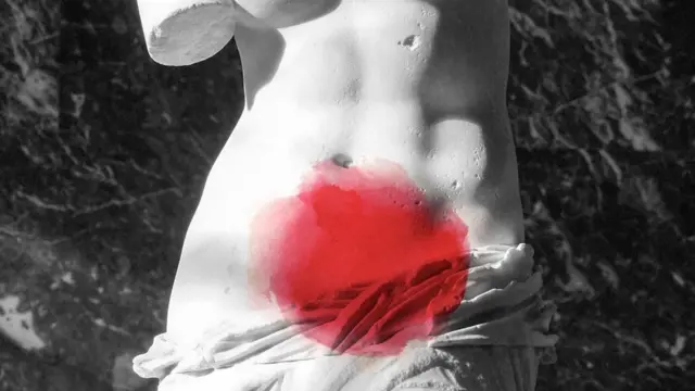 Ендометріоз