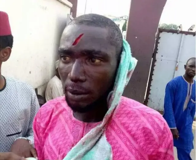 Wani da aka ji wa rauni a Kano