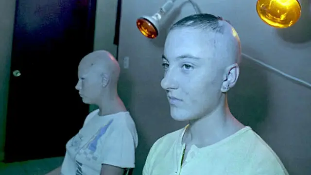 Dos adolescentes víctimas de la radiación recibiendo tratamiento en Cuba.