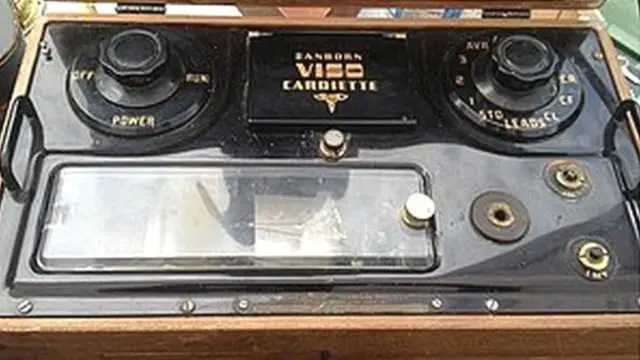 श्रीनिवास की ईसीजी मशीन