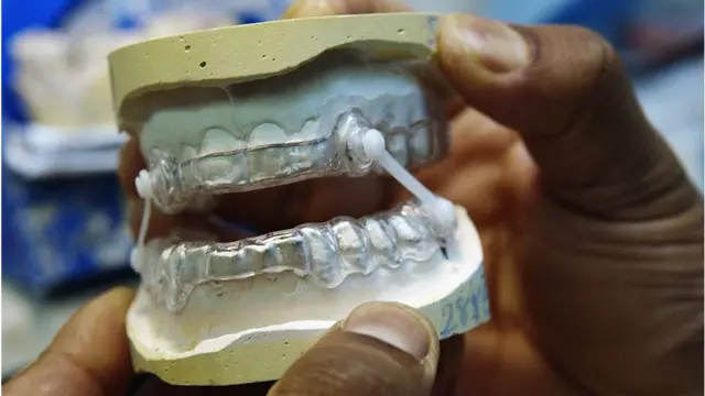 Awọn eroja bi eyi to wa ninu aworan yii 'Mouth silencer', ma n mu adinku ba bi eeyan ṣe n han'run