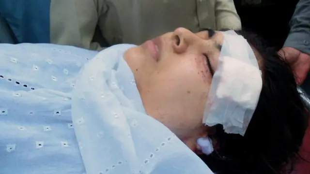 ઘાયલ મલાલા