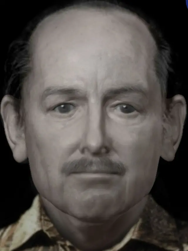 reconstrução facial