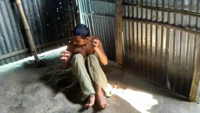 পাঁচ বছর ধরে পায়ে শিকল দিয়ে আটকে রাখা হয় রঞ্জন চন্দ্রকে।