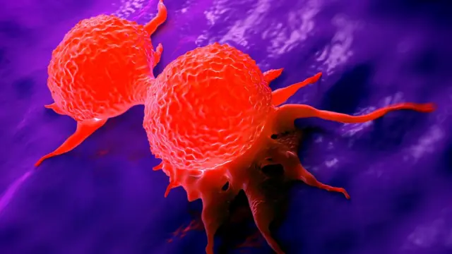 Células de cáncer de mama