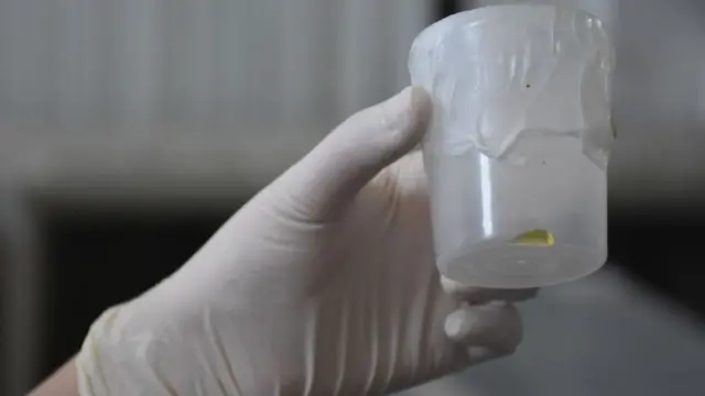 ઍન્ટિ-ડૉટ્સ તરીકે વપરાતું સાપનું ઝેર