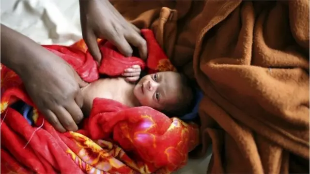 সিজারিয়ান মা ও শিশু উভয়কেই অস্ত্রোপচারের ঝুঁকিতে ফেলে