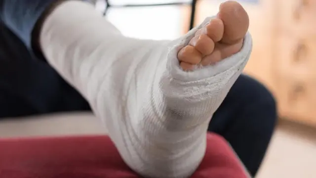 Перелом ноги