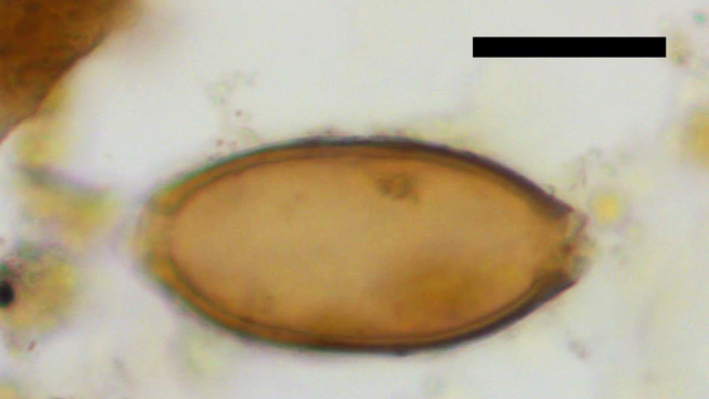 huevo de parásito en heces