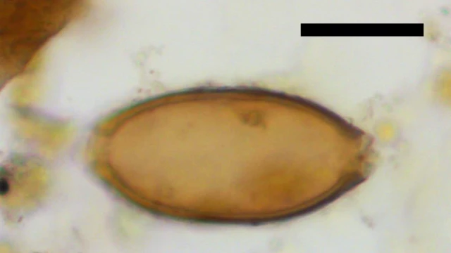 Huevo de parásito hallado en un coprolito
