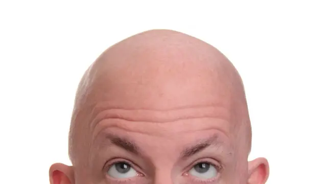 Un hombre pelado se mira la cabeza