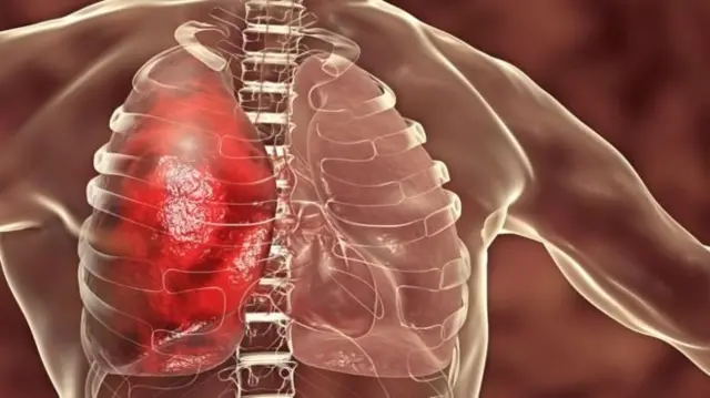 கொரோனா நோயாளிகளுக்கு ரத்தம் உறையும் பிரச்சனை ஏற்படுவது ஏன்?