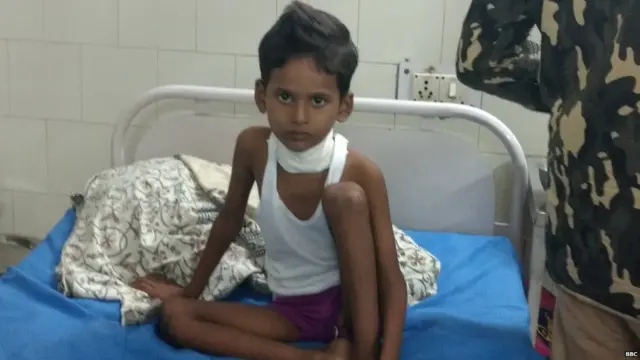 डिप्थीरिया, महर्षि वाल्मीकि संक्रामक रोग अस्पताल