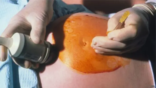 కవల పిల్లలు