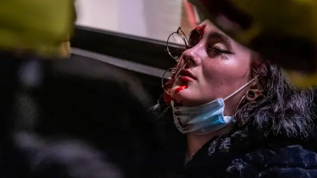 Una chica es atendida tras sufrir una herida grave en el ojo.