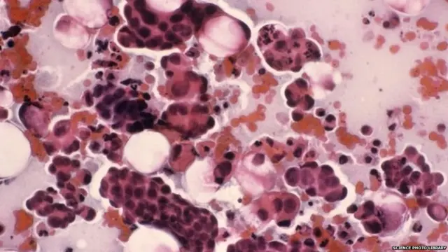 गर्भाशय