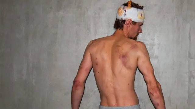 Никита Домрачев