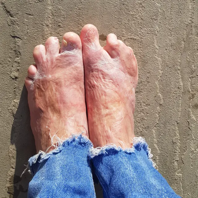 लॉरा के पैर