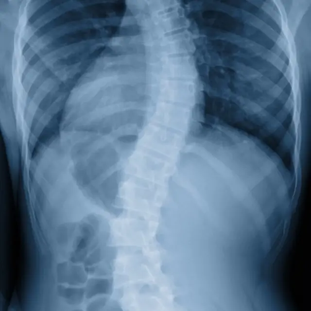 వెన్నుపాము